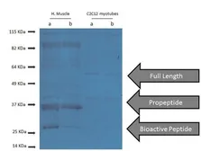 Anti-GDF8 / Myostatin antibody used in Western Blot (WB). GTX03461