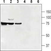 Anti-SLC47A1 antibody used in Western Blot (WB). GTX03645