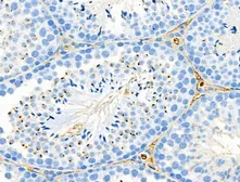 Anti-RanBP17 antibody used in IHC (Paraffin sections) (IHC-P). GTX03675