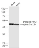 Anti-PPAR alpha (phospho Ser12) antibody used in Western Blot (WB). GTX03713