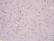 Anti-SLCO2B1 antibody used in IHC (Paraffin sections) (IHC-P). GTX03731