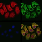 Anti-CA125 antibody used in Immunocytochemistry/ Immunofluorescence (ICC/IF). GTX03800
