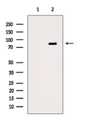 Anti-DMP1 antibody used in Western Blot (WB). GTX04077