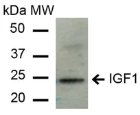 Anti-IGF1 antibody used in Western Blot (WB). GTX04087