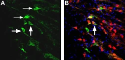 Anti-NMDAR2D antibody used in IHC (Free Floating) (IHC (Free Floating)). GTX04109