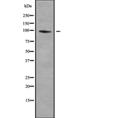 Anti-NHE3 antibody used in Western Blot (WB). GTX04111
