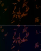 Anti-NALP1 antibody used in Immunocytochemistry/ Immunofluorescence (ICC/IF). GTX04254