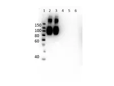 Anti-Hemoglobin beta antibody [14G2.G11.F11] used in Western Blot (WB). GTX04267