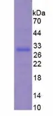 Mouse Cardiac Troponin I protein, His tag. GTX04344-pro