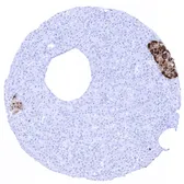 Anti-Chromogranin A antibody [MSVA-380R] HistoMAX&trade; used in IHC (Paraffin sections) (IHC-P). GTX04370