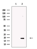 Anti-OMP antibody used in Western Blot (WB). GTX04493