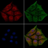 Anti-Fibronectin antibody used in Immunocytochemistry/ Immunofluorescence (ICC/IF). GTX04498