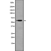 Anti-NUR77 antibody used in Western Blot (WB). GTX04510