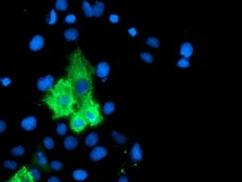 Anti-ALOX15 antibody [OTI3G8] used in Immunocytochemistry/ Immunofluorescence (ICC/IF). GTX04520