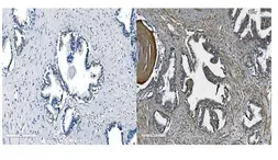 Anti-CDH11 antibody used in IHC (Paraffin sections) (IHC-P). GTX04544