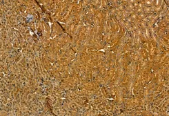 Anti-MMP9 antibody used in IHC (Paraffin sections) (IHC-P). GTX04573