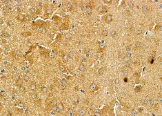 Anti-ASAP1 antibody used in IHC (Paraffin sections) (IHC-P). GTX04589