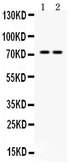 Anti-MDMX / MDM4 antibody used in Western Blot (WB). GTX04638
