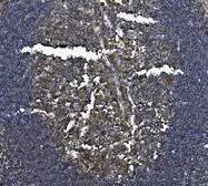 Anti-IL3 Receptor beta antibody used in IHC (Paraffin sections) (IHC-P). GTX04641