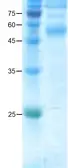 Dengue virus type 2 Envelope protein. GTX04675-pro