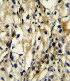 Anti-BCAT1 antibody used in IHC (Paraffin sections) (IHC-P). GTX04695