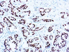 Anti-Estrogen Receptor antibody [SP1] used in IHC (Paraffin sections) (IHC-P). GTX04741