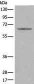 Anti-CENPT antibody used in Western Blot (WB). GTX04820