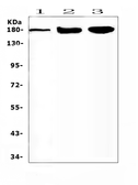 Anti-SUR1 antibody used in Western Blot (WB). GTX04855