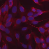 Anti-NDP52 antibody [9E2F2] used in Immunocytochemistry/ Immunofluorescence (ICC/IF). GTX04863