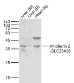Anti-SLC25A28 antibody used in Western Blot (WB). GTX04929