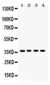 Anti-FOXA3 antibody used in Western Blot (WB). GTX04941