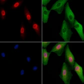 Anti-NEIL2 antibody used in Immunocytochemistry/ Immunofluorescence (ICC/IF). GTX04947