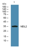 Anti-NEIL2 antibody used in Western Blot (WB). GTX04948