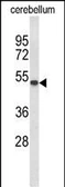 Anti-GAL3ST1 antibody used in Western Blot (WB). GTX04952