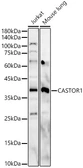 Anti-GATSL3 antibody used in Western Blot (WB). GTX04958