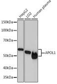 Anti-Apolipoprotein L1 antibody [ARC1124] used in Western Blot (WB). GTX04962