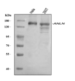 Anti-Anillin antibody used in Western Blot (WB). GTX04984