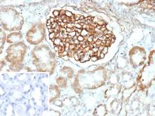 Anti-PLA2R1 antibody [PLA2R1/4893] used in IHC (Paraffin sections) (IHC-P). GTX05008