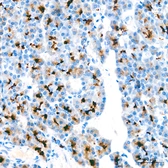 Anti-MUC1 antibody [ARC0352] used in IHC (Paraffin sections) (IHC-P). GTX05027