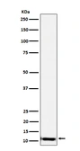 Anti-SPINK1 antibody [22S26] used in Western Blot (WB). GTX05088