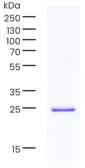 Human Cardiac Troponin I protein. GTX05105-pro