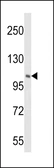 Anti-PI4 kinase beta antibody used in Western Blot (WB). GTX05121