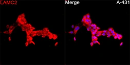 Anti-Laminin gamma 2 antibody used in Immunocytochemistry/ Immunofluorescence (ICC/IF). GTX05124