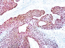 Anti-p63 antibody [DBR16.1] (ready-to-use) used in IHC (Paraffin sections) (IHC-P). GTX05134
