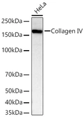 Anti-Collagen IV antibody [ARC62585] used in Western Blot (WB). GTX05165