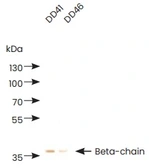 Anti-D-Dimer antibody [DD46] used in  (). GTX05175