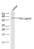 Anti-Fas Ligand antibody used in Western Blot (WB). GTX05180