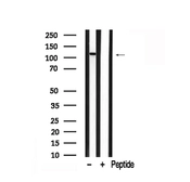 Anti-PLD1 antibody used in Western Blot (WB). GTX05184