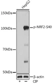 Anti-NRF2 (phospho Ser40) antibody [ARC0283] used in Western Blot (WB). GTX05239