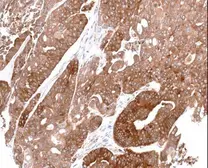 Anti-ALDH1A1 antibody [C3], C-term used in IHC (Paraffin sections) (IHC-P). GTX100043